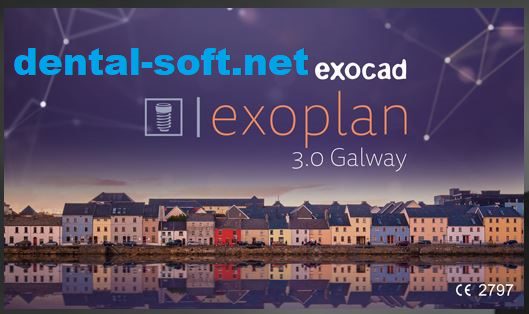 Read more about the article exocad-exoplan3.0-2020-12-15