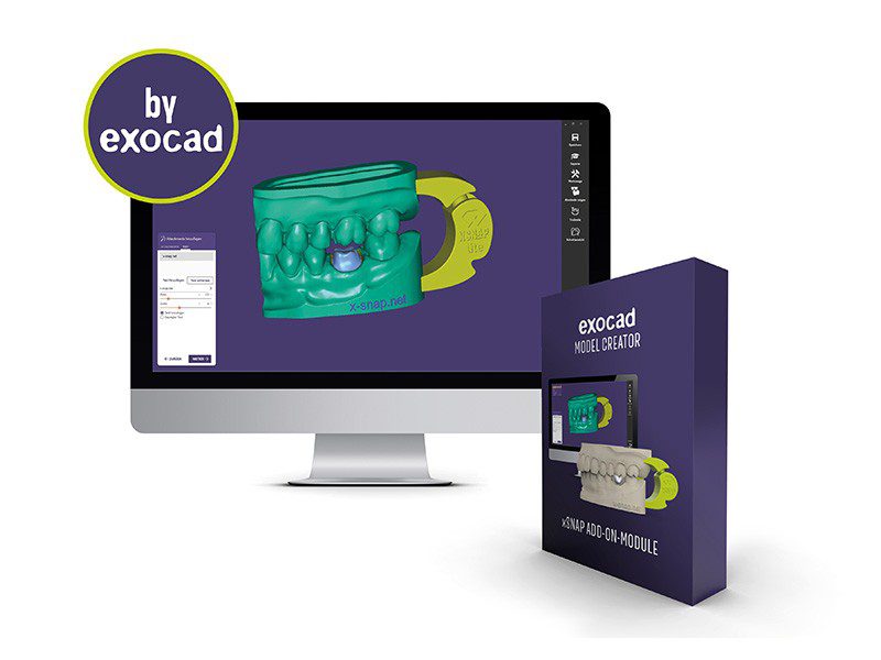 Read more about the article xSNAP® Add-on module for Model Creator (Exocad)