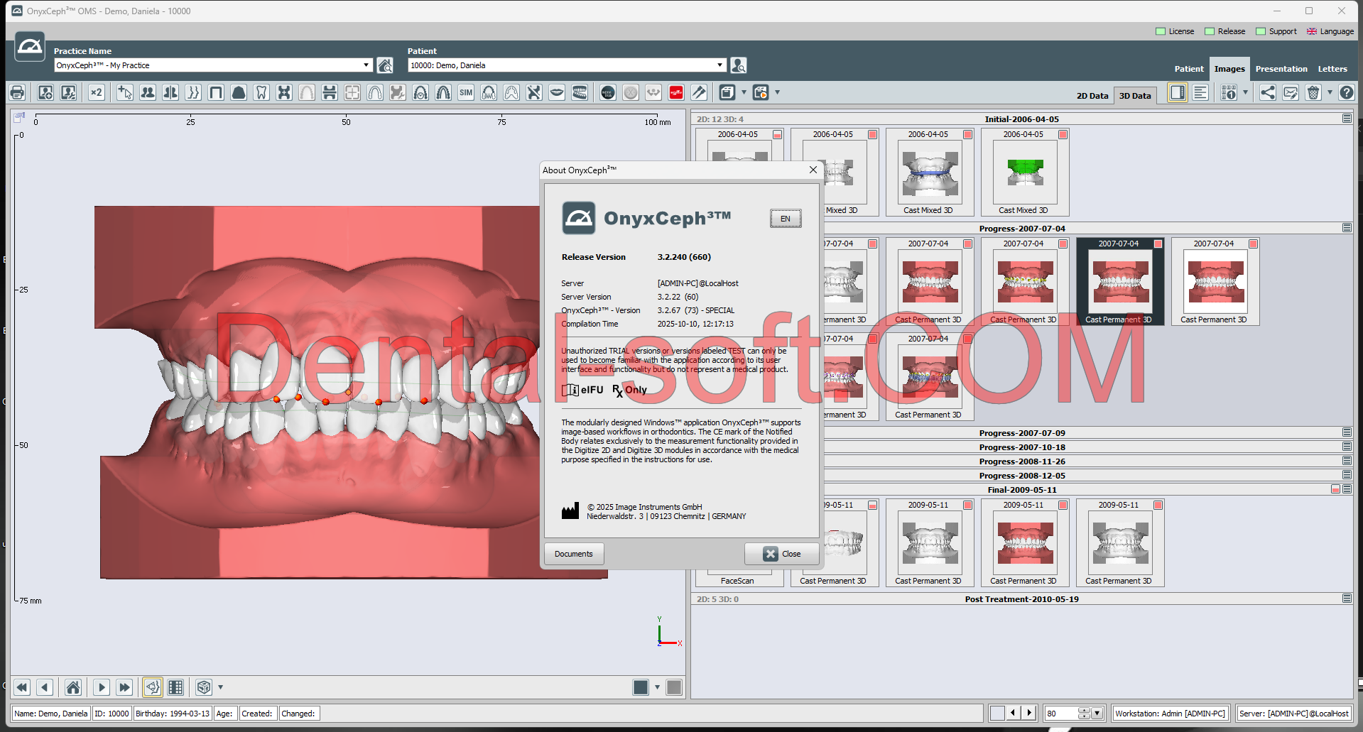 OnyxCeph 2025 Full crack